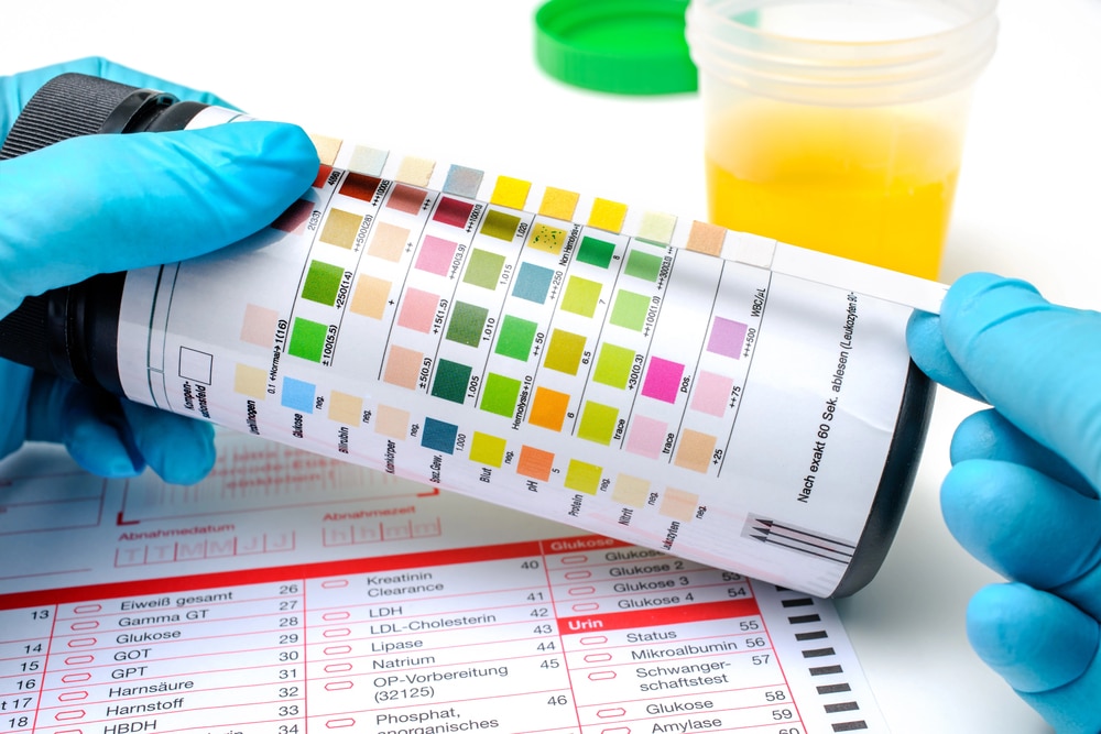 drug test to determine how long does suboxone stay in your system